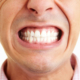 Bruxism