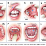 Dental Exam