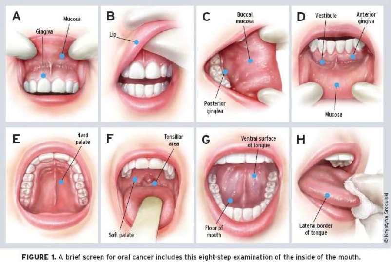 Dental Exam